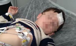 Elektrik çarpan çocuk yaralandı!
