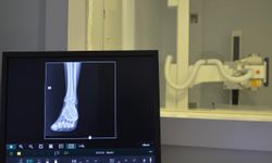 Erol Olçok Eğitim ve Araştırma Hastane dijital röntgen cihazı kazandırıldı