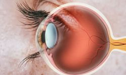 Sakın gözünüze tutmayın: Rahatlamak için tuttu, retinası yırtıldı