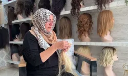 12 yaşında saçlarını ve kulaklarını kaybeden kadının şaşırtan değişim hikayesi