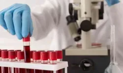Bu kan grubuna sahip olanlar dikkat: Hastalıklara karşı direnciniz daha düşük olabilir