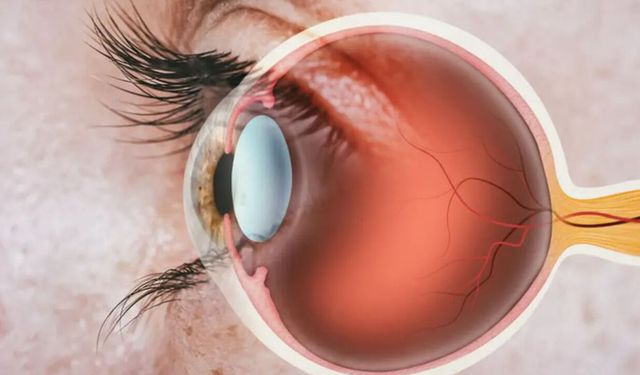 Sakın gözünüze tutmayın: Rahatlamak için tuttu, retinası yırtıldı
