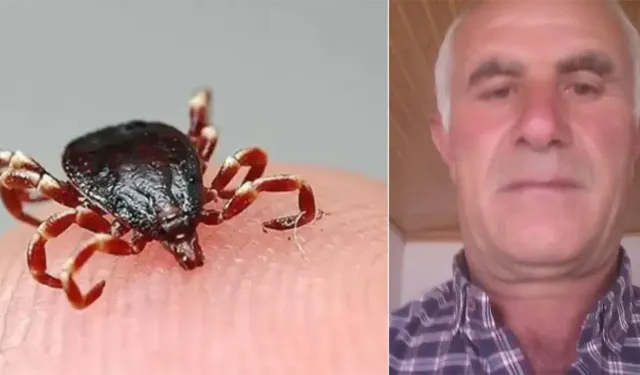 Sakın bunu yapmayın! 61 yaşındaki vatandaş keneyi kendi çıkarınca canından oldu!