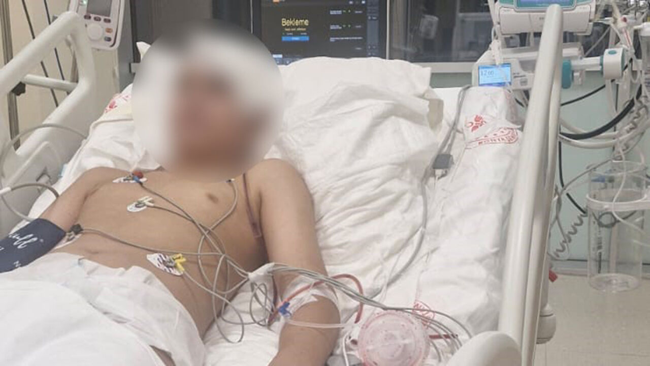 Akran Zorbalığı Az Kalsın Can Alıyordu Kafatası Titanyumla Toplandı